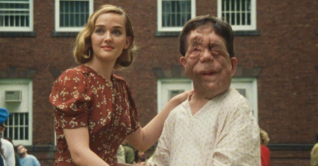 Adam Pearson Calls On Casting Directors To Be Bolder When Considering Disabled Actors News Screen