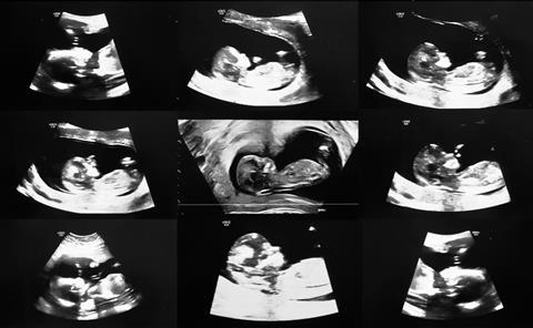 2026_FORUM_MATRESCENCE_Main still