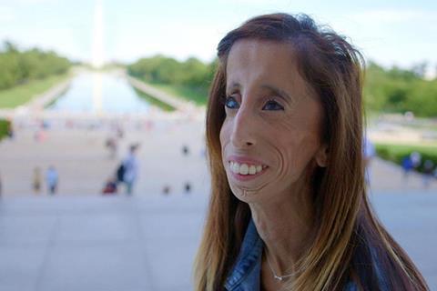 A Brave Heart: The Lizzie Velasquez Story