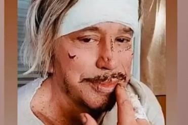 Mickey Rourke